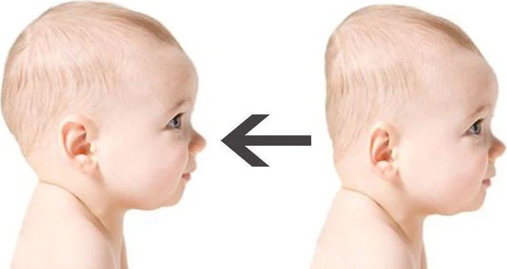 כרית תינוק ויסקו עם שקע למניעת ראש שטוח - Image 3